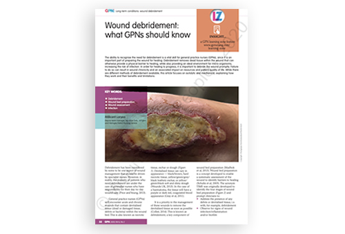 Wound debridement: what GPNs should know