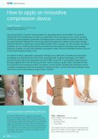 How to apply an innovative compression device
